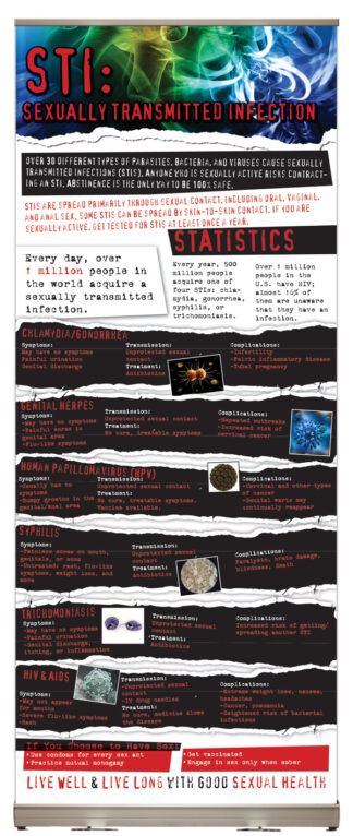 In the Know: STI - Sexually Transmitted Infection Presentation Display