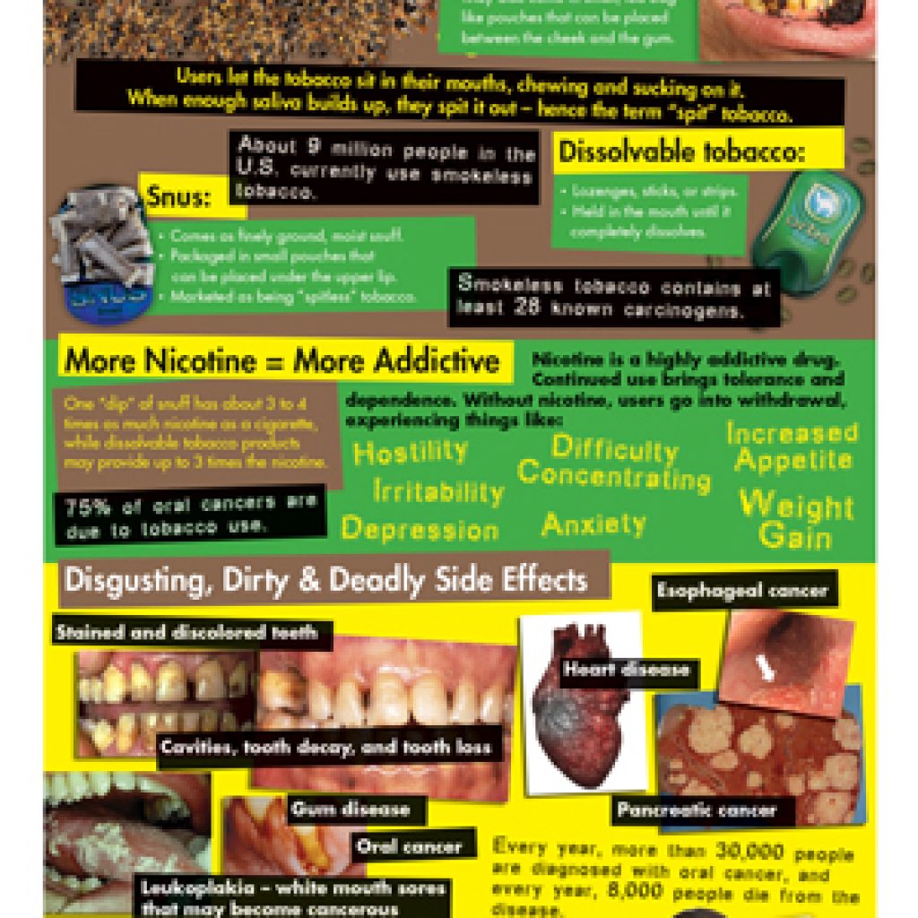 Smokeless Tobacco Retractable Display Prevention Resources